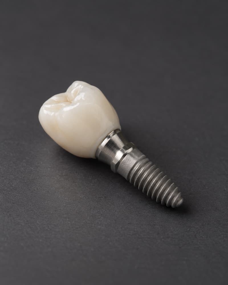 A dental implant post with a ceramic crown attached